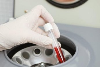 Американцы вливают кровь подростков для омоложения