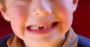 Смысл снов о выпадающих зубах: расшифровка и толкование