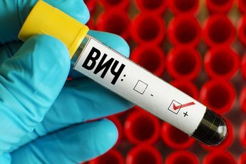 Ученые поняли, где в организме прячется ВИЧ