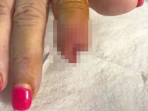 Женщина потеряла палец после посещения салона красоты