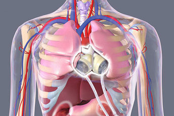 Российские ученые успешно создают искусственные сердца