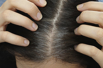 Причины преждевременного поседения волос