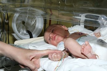 Самого маленького новорожденного ребенка в мире выходили врачи США